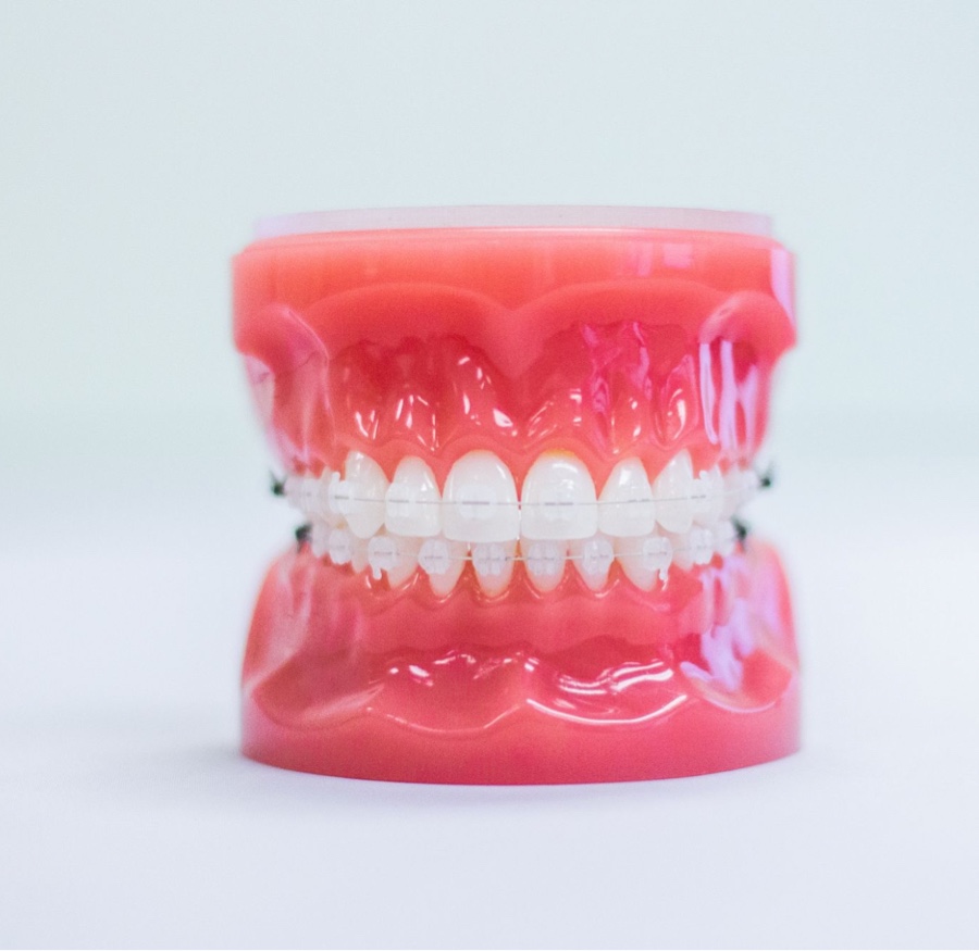 clear ceramic braces on plastic model