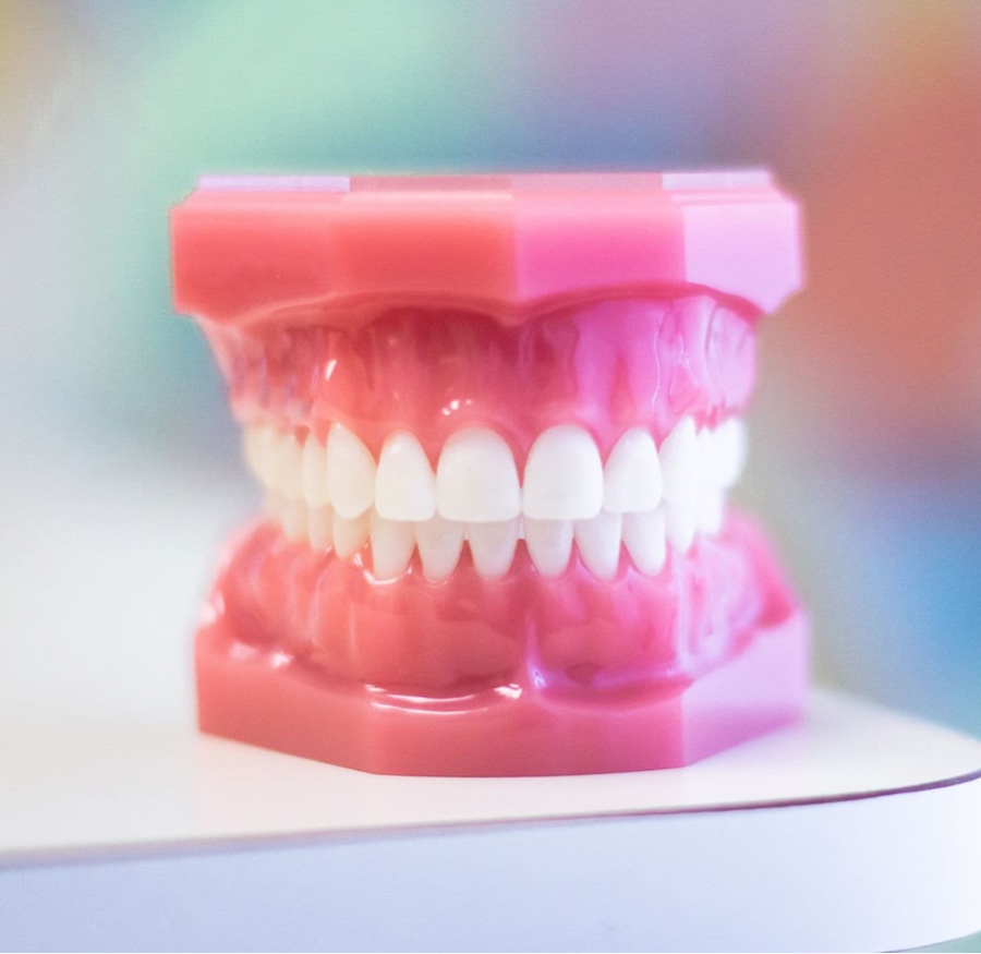 lingual braces on plastic model