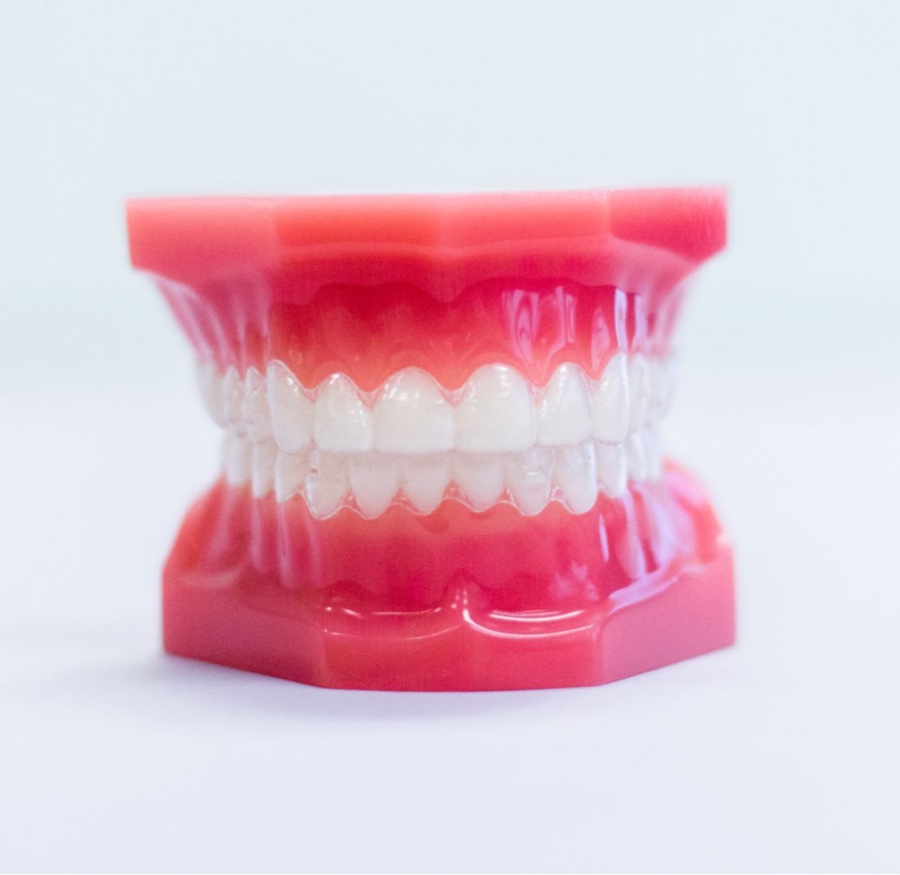 invisalign aligners on plastic model