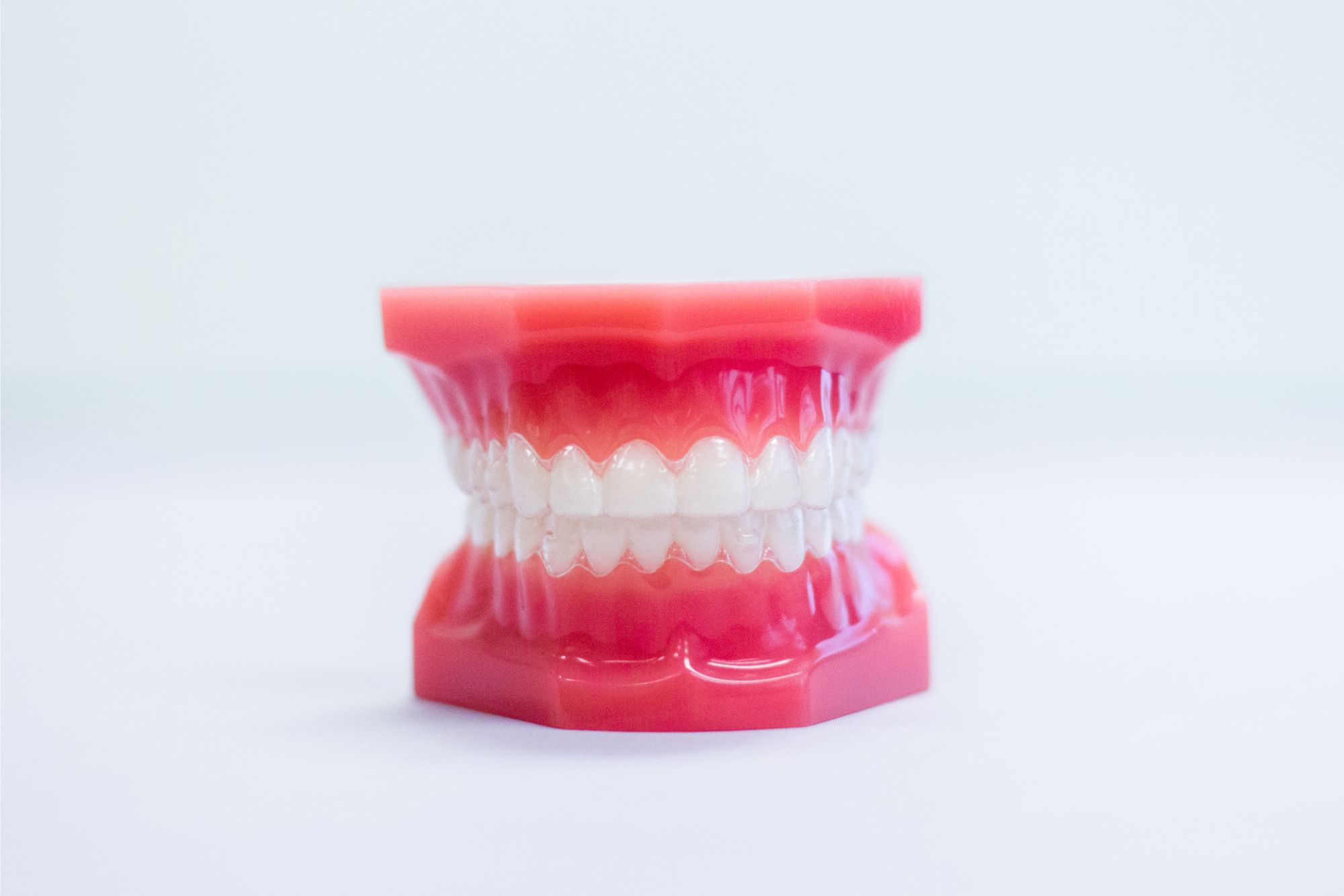 clear aligners typodont
