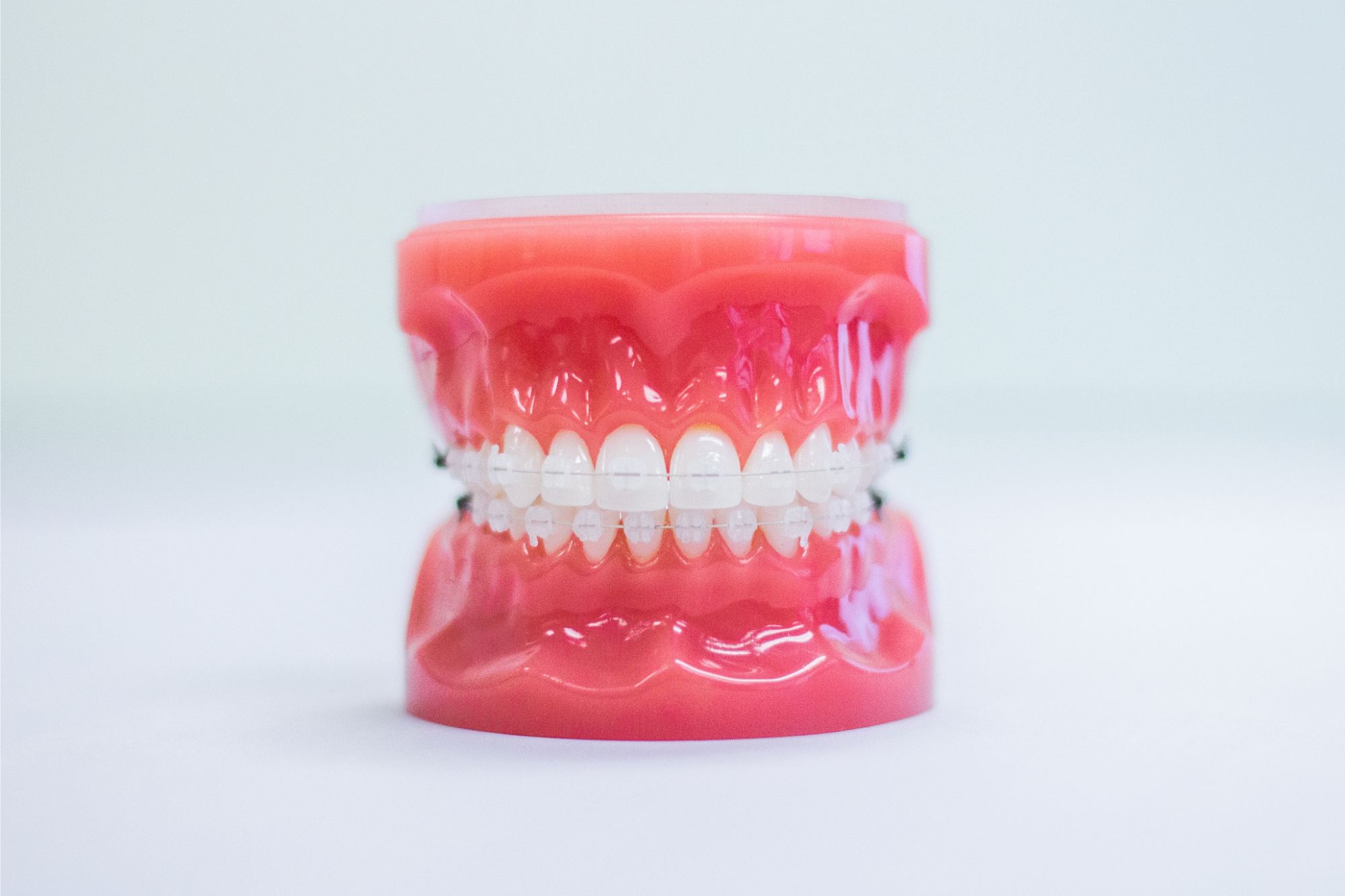 clear braces typodont