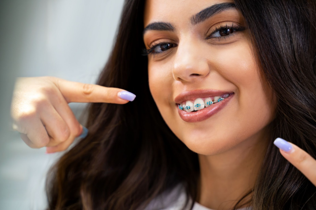 The Best Type of Braces for Adults