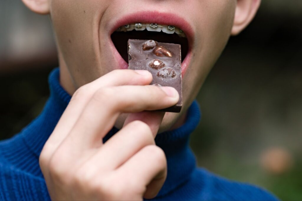 Braces-Friendly Holiday Treats and Tips for the Festive Season