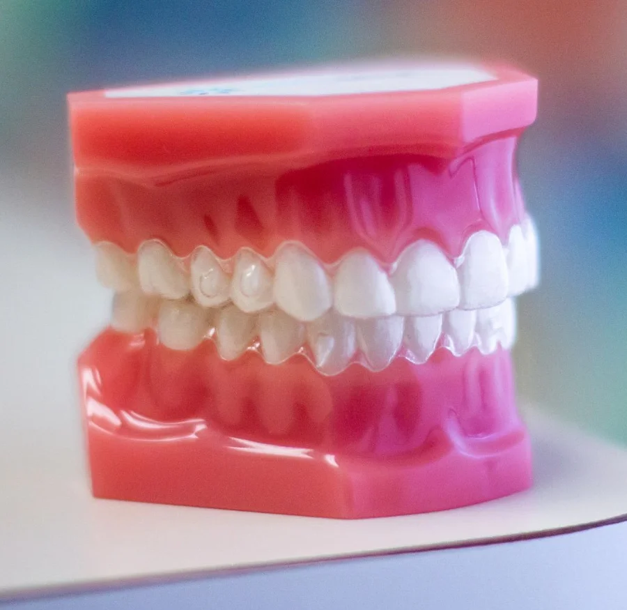 clear ceramic braces on plastic model